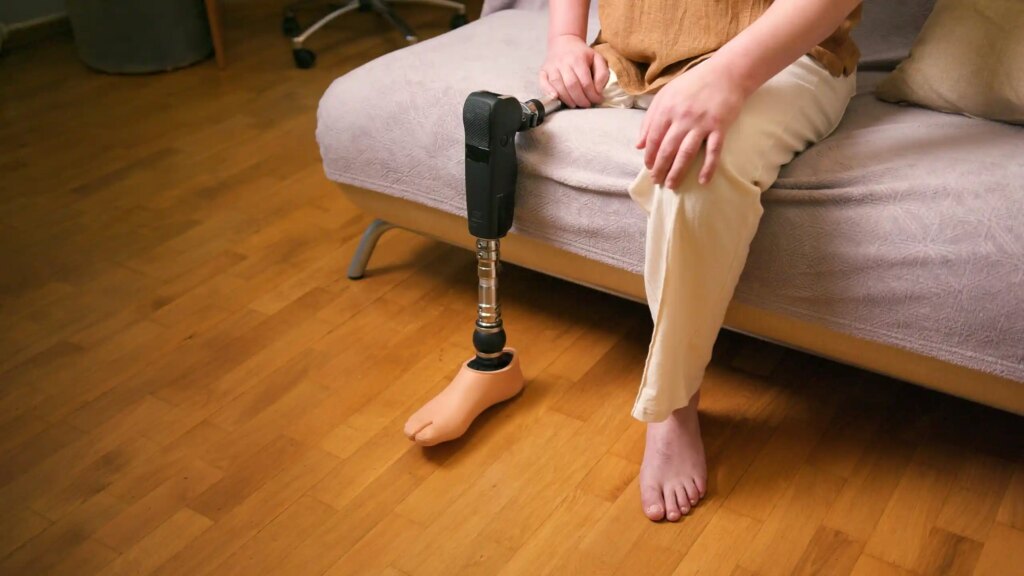 Minnesota attorney helping clients pursue limb loss workers’ comp benefits.